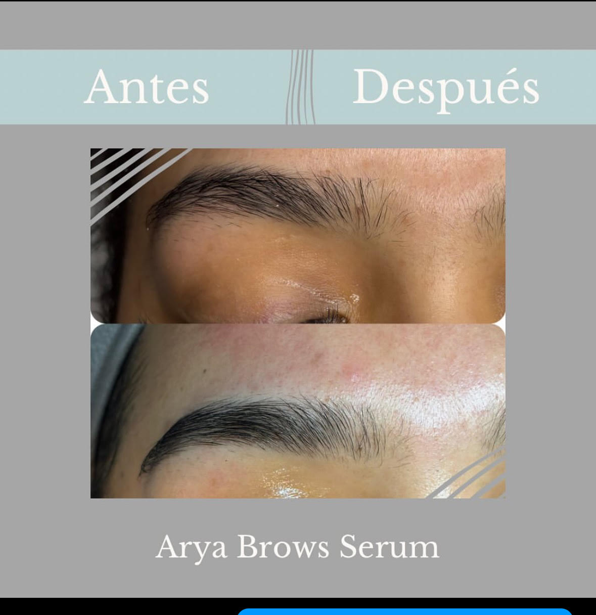 Serum de crecimiento