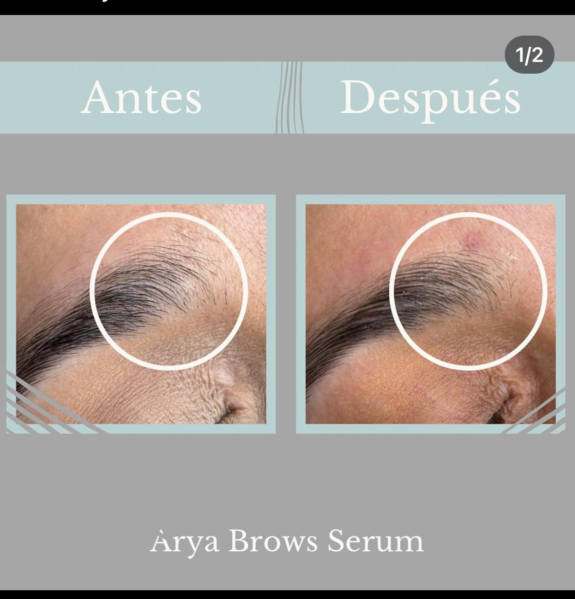 Serum de crecimiento